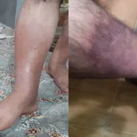 زیبایی درمانی|خدمات آرایشگری و زیبایی|بوشهر, |دیوار