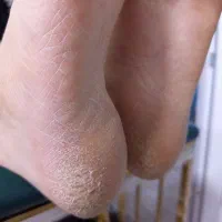 کفسابی و پدیکور پا بصورت تخصصی مخصوص بانوان|خدمات آرایشگری و زیبایی|اسلامشهر, شهرک امام حسین (میان آباد)|دیوار