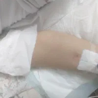 خدمات پرستاری و تزریقات در منزل محمودآباد|خدمات آرایشگری و زیبایی|محمودآباد, |دیوار