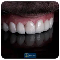 منشی و کال سنتر دندانپزشکی|استخدام درمانی، زیبایی، بهداشتی|تهران, خرمشهر|دیوار
