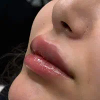 ژل و بوتاکس کلینیک زیبایی دکترفرشیدکریمی|خدمات آرایشگری و زیبایی|کرمانشاه, |دیوار