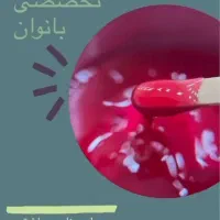 اپیلاسیون تخصصی