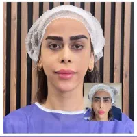 مدل کاشت ابرو فقطو فقط هفت تومن