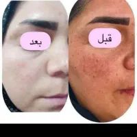 کرم vipاصل تضمینی|آرایشی، بهداشتی، درمانی|یاسوج, |دیوار