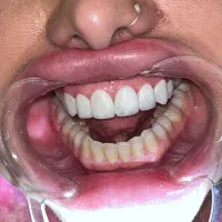 خدمات درمانی و زیبایی دندانپزشکی