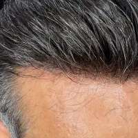 انواع پروتز مو فقط اورجینال وارداتی(نقد و اقساط)|آرایشی، بهداشتی، درمانی|تهران, فردوس|دیوار