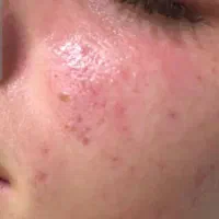 جشنواره فیشیال و پاکسازی و کلیه امور پوست و مو|خدمات آرایشگری و زیبایی|فردیس, فردیس|دیوار