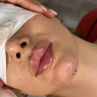 ژل لب