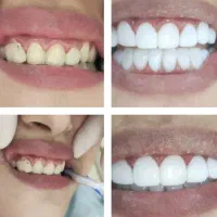 دندون پزشکی