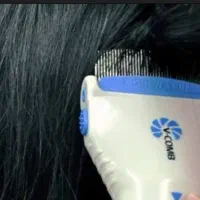 پاک سازی سر با دستگاه رشک و شپش و مژه موقت  توس ۹۷