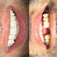 مرکز تخصصی دندانپزشکی ایمپلنت جراحی با گارانتی