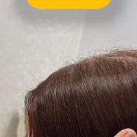 پاکسازی سر،موخوره گیری،اسکالپ،درمان ریزش،رویش مجدد|خدمات آرایشگری و زیبایی|قم, هفت تیر|دیوار
