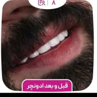 مرکزفوق تخصصی ایمپلنت دیجیتال/ایمپلنت فوری/بی درد|خدمات آرایشگری و زیبایی|مشهد, کوه سنگی|دیوار