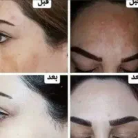 کرم معجزه شب اصل|آرایشی، بهداشتی، درمانی|دورود, |دیوار