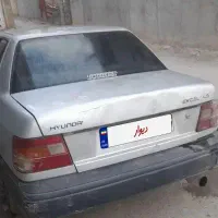 هیوندا اکسل ۱۹۹۴