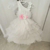 پیراهن بچه