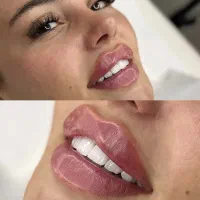 استخدام دستیار پزشک زیبایی
