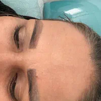 کلینیک تخصصی ریموتتوبا لیزر کیوسوئیچ و کربن تراپی|خدمات آرایشگری و زیبایی|مشهد, احمدآباد|دیوار