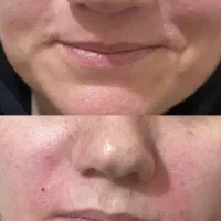 آف ویژه بالن وبوتاکس معده،ژل و بوتاکس وبفاروپلاستی|خدمات آرایشگری و زیبایی|اهواز, کیانپارس |دیوار