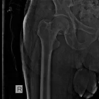 عکس رادیولوژی در منزل