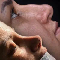 جراحی بدون نقص و متفاوت|خدمات آرایشگری و زیبایی|تهران, ازگل|دیوار