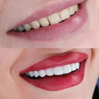 مرکز تخصصی کامپوزیت در شیراز مطب دندانپزشکی|خدمات آرایشگری و زیبایی|شیراز, ملاصدرا|دیوار