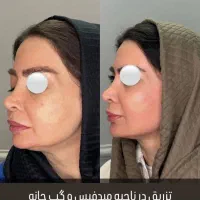بوتاکس چشم گربه ای ۵۹۹ژللب روسی۱/۲۰۰مادلینگ۶میلیون|خدمات آرایشگری و زیبایی|قم, حاج زینل|دیوار