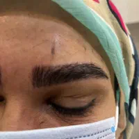 مدل کاشت ابرو|خدمات آرایشگری و زیبایی|گرگان, |دیوار