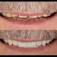 کلیه خدمات دندانپزشکی مناسب همه|خدمات آرایشگری و زیبایی|کرمانشاه, |دیوار