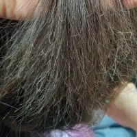 موخوره گیری ۲۵۰ کفسابی فر و کراتین