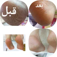 اتاق پوست بارشین با بهترین برندوقیمت