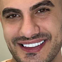 کامپوزیت دندان فکی ۳میلیون