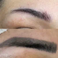 ریموو تاتو تک جلسه ای|خدمات آرایشگری و زیبایی|تربتحیدریه, طالقانی|دیوار