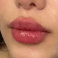 دکتر اکرم آقابیگی پوست مو زیبایی|خدمات آرایشگری و زیبایی|ملایر, |دیوار