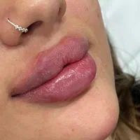 اموزش و مدل تزریق ژل و بوتاکس و فیلر|خدمات آرایشگری و زیبایی|شیراز, معالی‌آباد|دیوار
