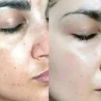 کرم معجزه اصلی تضمینی