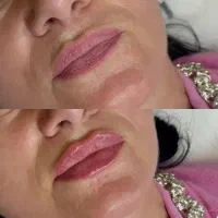 کلینیک تخصصی ژل و فیلر،لیپو و..|خدمات آرایشگری و زیبایی|شهریار, شهریار|دیوار