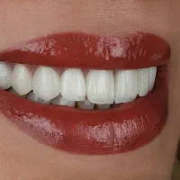 دندانپزشکی از دم قسط با بی حسی بدون درد دیجیتال