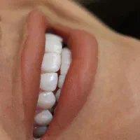 تخفیف ویژه ۲۰٪خدمات دندانپزشکی|خدمات آرایشگری و زیبایی|شیراز, ارم|دیوار