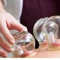 آموزش حجامت و زالو درمانی و بادکش به صورت تخصصی