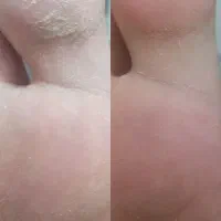 ررفع خشکی و تیرگی قوزک پا 200هزارتومن|خدمات آرایشگری و زیبایی|نجفآباد, الله اکبر|دیوار