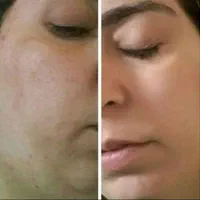 کرم معجزه شب اصلی
