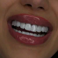 کامپوزیت سارمکو فکی هشت تومن