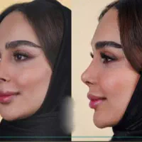 عمل و جراحی کلینیک زیبایی بینی لیفت لیپو و ابدو