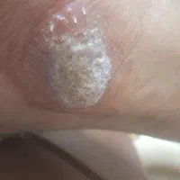 انواع خدمات زیبایی|خدمات آرایشگری و زیبایی|کرج, گلشهر|دیوار