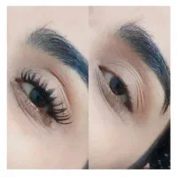 کاشت مژه هیدن