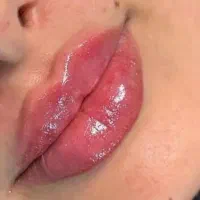 جشنواره پک مادلینگ +بوتاکس رایگان(فک لب گونه چانه)|خدمات آرایشگری و زیبایی|قم, زنبیل آباد|دیوار