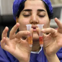 لیپوفیس حذف چربی ها اضافه و زاویه سازی دائمی صورت