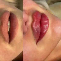 جشنواره ژل و بوتاکس|خدمات آرایشگری و زیبایی|کاشان, کشاورز|دیوار