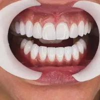 آموزش کامپوزیت و دندانپزشکی برای همه ی افراد